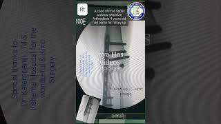 Arthrodesis knee | Post operative follow up | Adamya Hospital videos