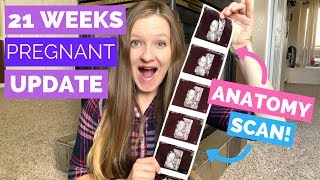 21 Week Pregnancy Update  |  ANATOMY SCAN!