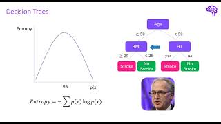 Explainable AI explained! | #2 By-design interpretable models with Microsofts InterpretML