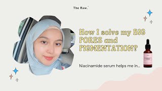 How The Raw. solved my BIG PORES and PIGMENTATION?