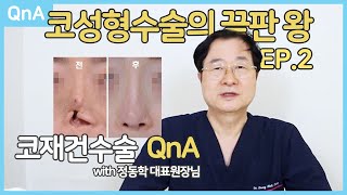 [QnA] 코를 새로 만드는 수술, 코재건수술에 대한 모든 것! 코재건수술 2편!!