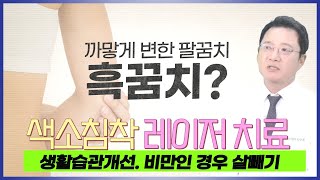 흑꿈치 팔꿈치 하얘지는 치료 원인을 알고 치료해야합니다.