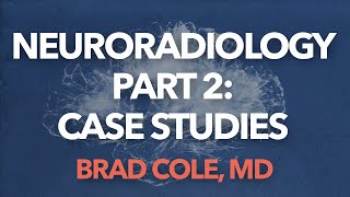 Neuroradiology Part 2: Case Studies