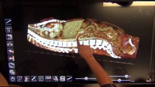 Anatomage Anatomy Review