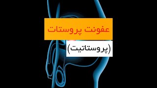 عفونت پروستات (پروستاتیت) - دکتر سید امین میرصادقی