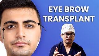 Eyebrow Hair Transplantation in India | Perfect Brows, Simple Procedure | New Roots Kolkata