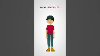 What's the deal with measles?