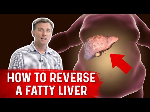 How to Reverse a Fatty Liver How to Reverse a Fatty Liver