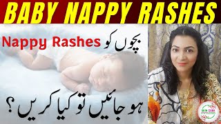 Baby Nappy Rashes | Nappy Rash Cream | Bachon K Diaper Rashes Ka Ilaj by Skin Care Dr Aisha  Ghias