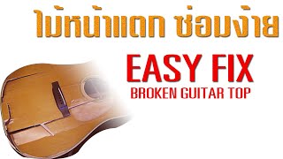 ซ่อมกีตาร์ไม้หน้าแตก ทำง่ายๆทำเองได้เลย  Easy Fix. How to fix a broken guitar top.