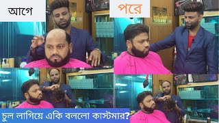 non surgical hair replacement in Bangladesh Hair Expert Shamim Call for details: 0195 200 4000