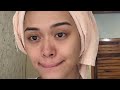 how i cleared my skin glass skin ang peg beauty vault rejuvenating set review maria selina