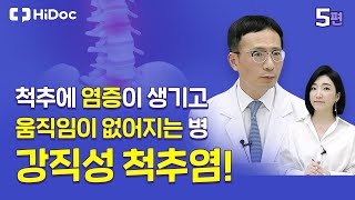 척추에 염증이 생기고 움직임이 없어지는 병 \