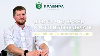 Ожоги что нужно и чего точно нельзя делать!