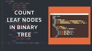 Total Leaf Nodes in Binary Tree | Python Code