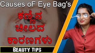 ತೊಡೆದುಹಾಕಲು Eye Bags | How To Get Rid of Eye Bags - Home Hacks | Beauty Tips By Kavya | NayaTV