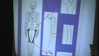 Why Blacks Are Good at Sports - Race Differences in Skeletal System