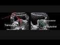 How to measure PROSTATE VOLUME on USG and MRI ? Here’s the Correct method.