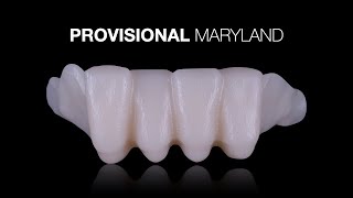 Provisional Maryland Bridge