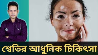 শ্বেতি রোগের ১০ ধরনের আধুনিক চিকিৎসা | Vitiligo Treatment In Bangla