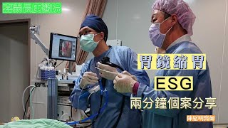 兩分鐘分享有效減重方法,胃鏡縮胃手術介紹(Endoscopic sleeve gastroplasty, ESG)