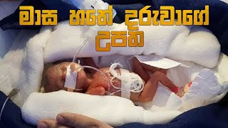 මාස හතේ දරුවාගේ උපත | delivery of 7 months baby l seven months baby born in critical condition