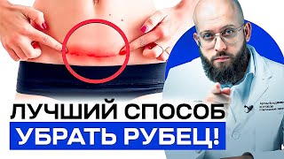 Как выполняется коррекция рубцов?