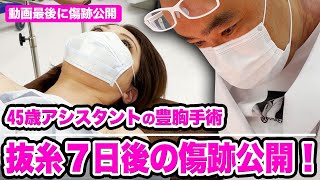 《抜糸後7日目の傷跡公開》豊胸手術の傷跡が目立つ？【教えて麻生先生】