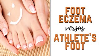 Types of Foot Eczema vs. Athlete's Feet: Symptoms, Causes \u0026 Natural Treatments