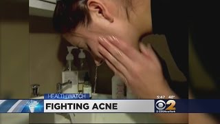 Dr. Max Gomez: Fighting Acne