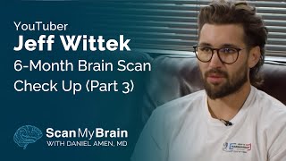 YouTuber Jeff Wittek 6-Month Brain Scan Check Up (Part 3)