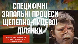 III.5 - Специфічні запальні процеси ЩЛД (актиномікоз, туберкульоз, сифіліс). Хронічний остеомієліт