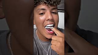 Como deixar os dentes brancos?