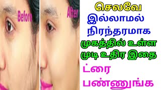 முகத்தில் உள்ள முடி உதிர இதை try பண்ணுங்க | Remove unwanted face hair | Beauty Tips in tamil