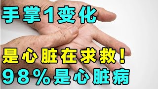 心脏好不好，看手就知道！若出现这3种情况，或是心脏在“求救”【养生大讲堂】