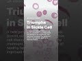 triumphs in sickle cell crispr sicklecellanemia