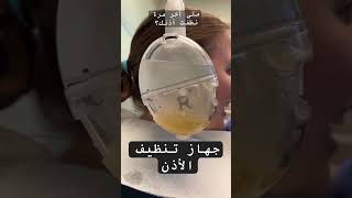 اسرع جهاز لتنظيف الأذن fastest machine clean ear #subscribe