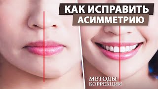 Асимметрия лица - причины возникновения. Как исправить асимметрию лица