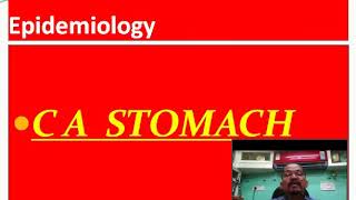 Cancer Stomach - Stages ...