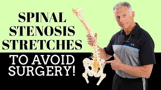 Best 3 Stretches To Quickly Remedy Lumbar Spinal Stenosis & Avoid Surgery!