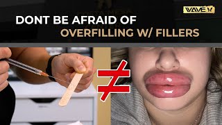 Why You Shouldn't Fear Getting Multiple Syringes of Fillers! (Facial Fillers)