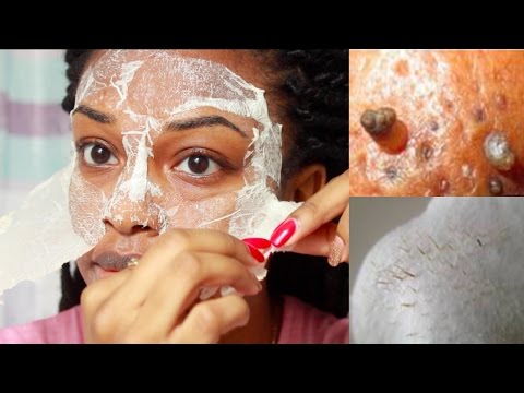 EASY DIY Egg Blackhead Remover Peel Off Mask EASY DIY Egg Blackhead Remover Peel Off Mask