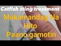 Paano gamutin (Hito) or CATFISH STING TREATMENT