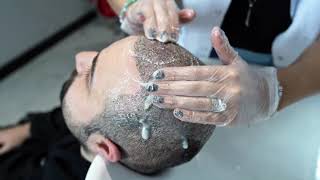 10th Day Washing After Hairtransplantation - Fatma Dursun