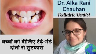 बच्चों में टेढ़े मेढ़े दातों का ईलाज । Pediatric Dentistry