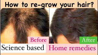 പോയ മുടി തിരിച് വരും 😍 4 TOP TIPS-Home Remedies for Hair Re-Growth| SCIENCE BASED |