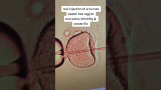 Real injection of sperm into a human egg to create a new life