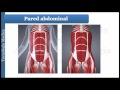 Radiologia Para Estudiantes: TC de pared abdominal