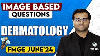 Dermatology | Image Based Questions | FMGE 2024 | Dr.Jazeer