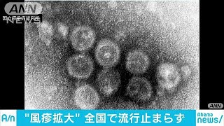 「風疹」全国流行止まらず　去年1年間の約7倍に(18/09/26)